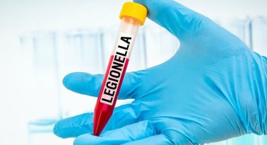 UKAS Accredited Legionella Testing
