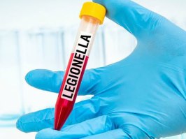 UKAS Accredited Legionella Testing