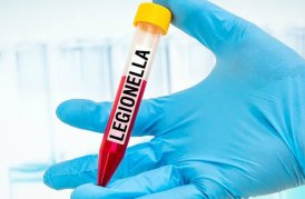 UKAS Accredited Legionella Testing